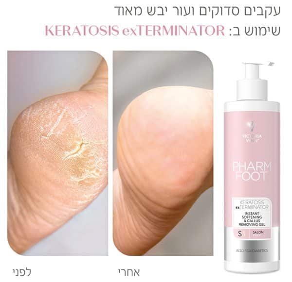 ⁦ג'ל ריכוך להסרת קאלוס ועור יבש KERATOSIS exTERMINATOR⁩ – תמונה ⁦2⁩